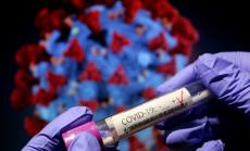 196 са новите случаи на коронавирус у нас при 2 003 PCR теста