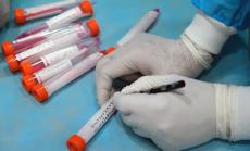 Над 10 хил. са вече хоспитализираните заради Covid-19 у нас 