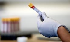 105 са новите случаи на коронавирус у нас при направени 2642 проби 