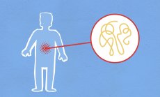 Учени са открили "Свещения Граал" в борбата с възпалителни заболявания на червата