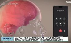Саркар: Чипът на Neuralink има 12 пациенти в САЩ и в чужбина