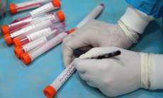 В интензивни отделения у нас се намират 729 души с коронавирус