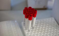 160 са новите случаи на заразени с Covid-19 у нас при направени 3526 PCR теста