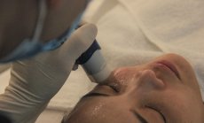 Ценовата война в Китай достигна до ботокс и грижата за кожата