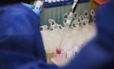 157 са новите случаи на коронавирус у нас при направени 7 639 PCR теста