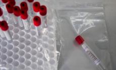 286 са новите случаи на Covid-19 у нас, най-много са новозаразените в София 