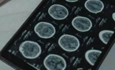 Мозъчните импланти могат да лекуват, но все още не могат да ни направят „по-добри хора“