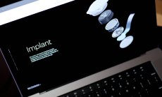 Невронно устройство на Neuralink накара маймуна да види нещо, което не съществува