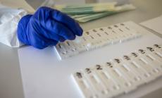 Коронавирусът у нас: 24% от направените тестове за последните 24 часа са положителни 