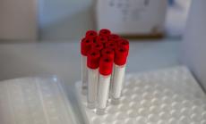 Коронавирусът у нас: 1595 положителни проби при направени 9038 теста