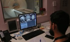 Какво трябва да знаем за Neuralink и първия чип имплантиран в човешки мозък