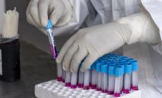 772 са новите случаи на Covid-19 за последното денонощие