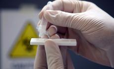 81 са регистрираните нови случаи на коронавирус у нас