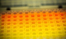 Европейският лекарствен сектор рискува да изостане от останалия свят