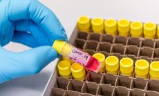 99 са новите случаи на коронавирус у нас при направени 4 787 PCR теста