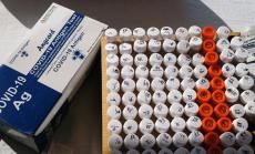 Над 9000 вече са хоспитализираните заради Covid-19 у нас