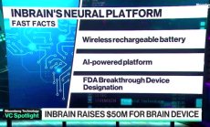Inbrain набра $50 млн финансиране за мозъчна сонда, част 1