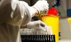 Коронавирусът у нас: 77 са новите случаи при направени 1194 теста