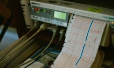 Кардиология и неврология са от най-обещаващите сфери за пробив в AI медицината