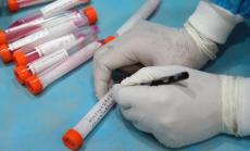 455 са новите случаи на Covid-19 у нас при направени 7 674 теста