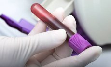 Китай ще тества кръв от 2019 г., за да намери причината за пандемията от Covid