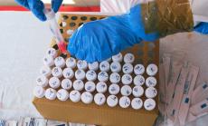 Положителни са 22,4% от направените тестове за Covid-19 у нас през последните 24 часа