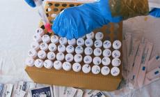 Положителните проби за Covid-19 у нас са 7,7% от направените тестове през последните 24 часа