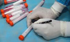 Малко над 7% от направените тестове за Covid-19 у нас са положителни