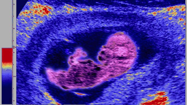Снимка: Bloomberg L.P.
