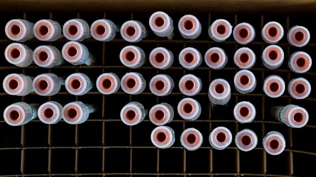 Снимка: David Paul Morris/Bloomberg