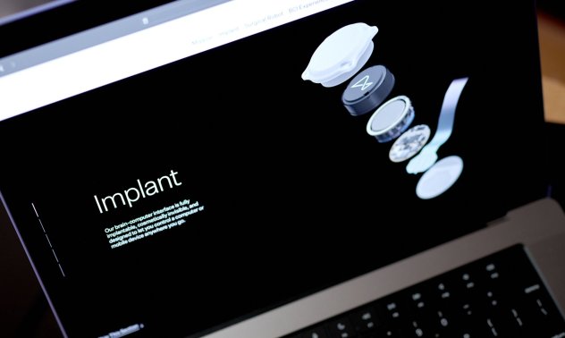 Чип в мозъка - Neuralink успя с роботизирана хирургия и гъвкави електроди