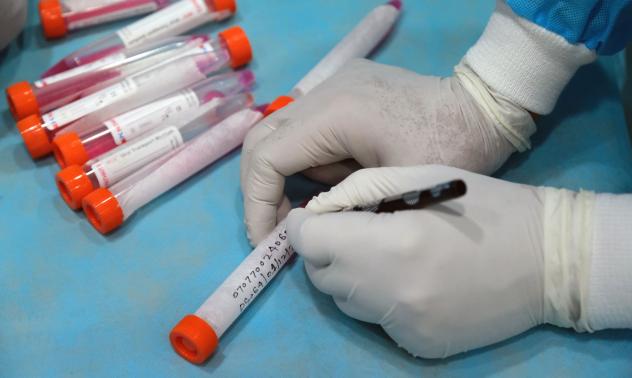 Новите случаи на коронавирус у нас са 182 при направени 2663 теста