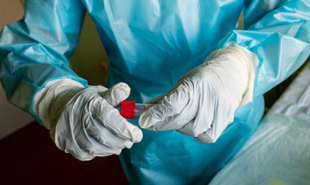 81 са новите случаи на коронавирус у нас